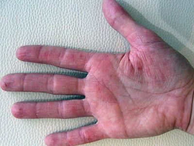 the palm of my sister's right hand