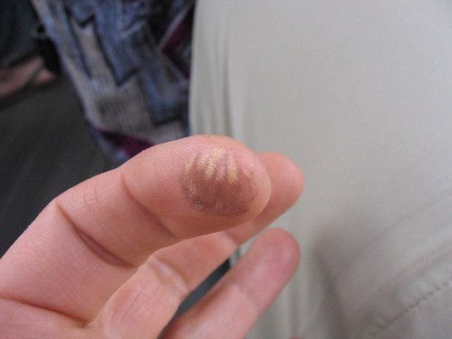 a fingertip with the pattern of a butterfly wing on it